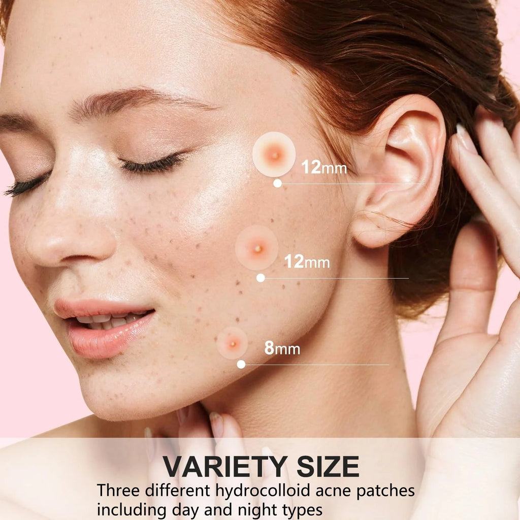 Hydrocolloid acne patches